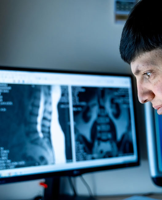 Overcoming 5 technical challenges of AI in medical imaging