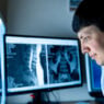 Overcoming 5 technical challenges of AI in medical imaging