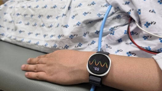 Samsung’s Galaxy Watch can predict when you might faint