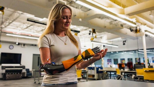 Access to 3D printed prosthetics for children