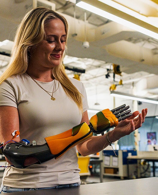 Access to 3D printed prosthetics for children