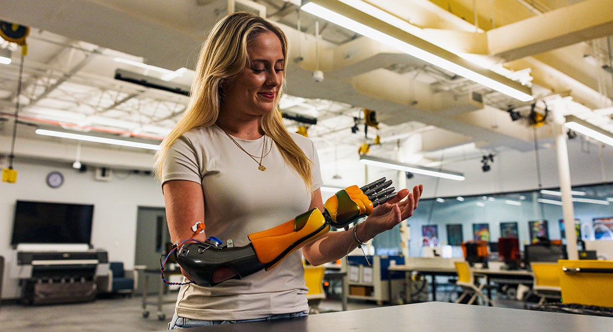 Access to 3D printed prosthetics for children